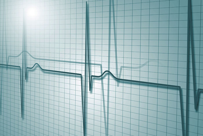 Diagnostic and Monitoring Equipment